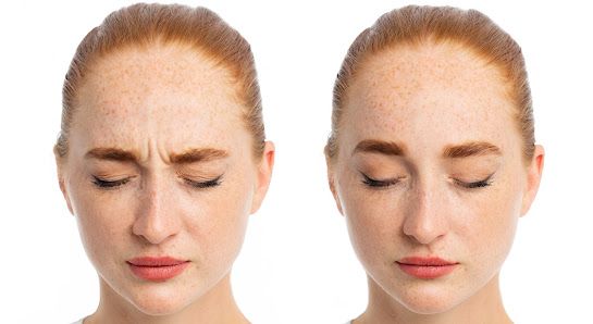 Dermal Plus Clinic Peterborough