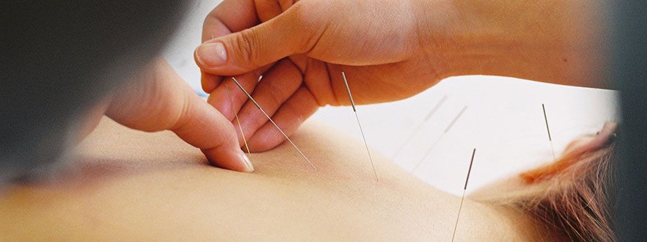 Acupuncture St. Albert