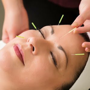 Acupuncture Lai & Associates