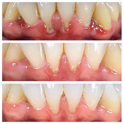 Dental Hygienist