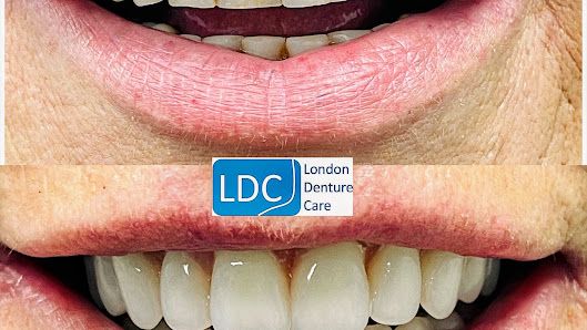 Dentures London