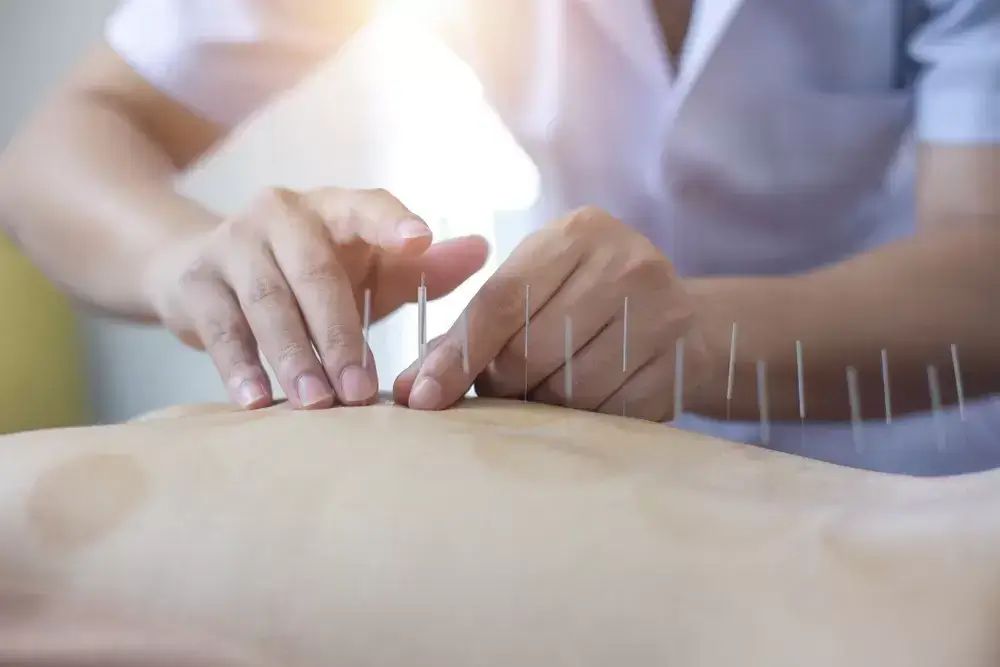 Mississauga Acupuncture Clinic