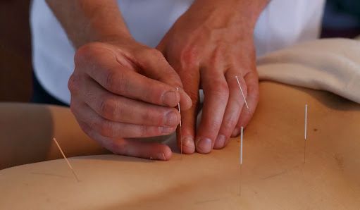 Acupuncture Laval Acupuncteur Dominic Ferland Ac