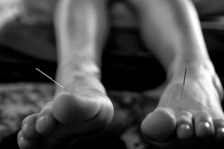 Acupuncture — Sage Earth Acupuncture